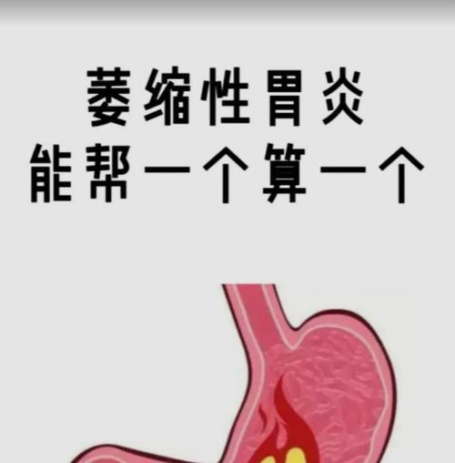 小鸟学会飞翔——别担心，我们都可以的（一只被捕鸟儿的奋斗史）